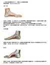 shoe Arch Insoles 足弓認識與護理資料收集