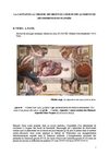 La cavitation à l'origine des bruits du coeur et des accidents de décompression lors de la plongée sous-marine.