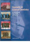 IMPLANTES DENTALES CLINICA