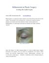 Los Angeles Eyelid Surgery - Blepharoplasty - Board Certified Plastic Surgeon