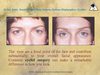 Dr Kris Reddy Reviews Blepharoplasty (eyelids)