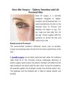 Browlift Surgery – Tighten, Smoothen and Lift Forehead Skin