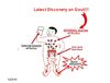 Truth of Gout Revealed -Which Stage of Gout Are You In Now?
