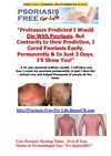 Scalp Psoriasis Treatment - New Treatment For Psoriasis