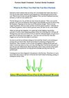 Psoriasis Hands Treatment - Psoriasis Herbal Treatment