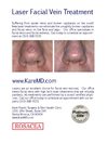 Laser Facial Vein Treatment in Los Angeles with board-certified physician - Dr. Karamanoukian 