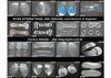 Silicone Insoles, Gel Insole, Orthotic Insoles, PU insole, TPR INSOLES, TPE shoe pads, foot care products...