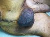TUMOR TESTICULAR
