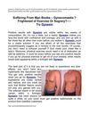 Gynexin Male Breast Reduction