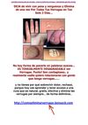  remedios caseros para las verrugas - como se quitan las verrugas - tratamiento para las verruga