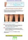  celulitis tratamiento casero - remedios para la celulitis