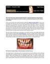 The Dentist in Laguna Niguel: Talking About Periodontal (Gum) Disease