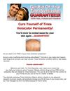  tinea versicolor treatment Get Rid Of YOur Tinea Versicolor Treatment