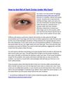 How to Get rid of Dark Circles Under My Eyes