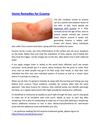Home Remedies for Eczema