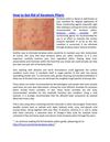 How to Get Rid of Keratosis Pilaris