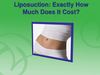 Liposuction Exactly How Much Does It Cost 