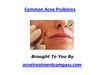What is Used to Treat Acne Cyst