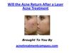 Will the Acne Return After a Laser Acne Treatment