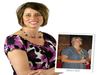 Gastric Lap Band Complications