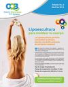 Boletín CQBelleza Lipoescultura