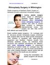 Rhinoplasty Surgery in Wilmington 