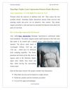 Smartlipo Triplex Laser Liposuction Ensures Faster Recovery