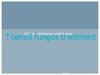 toenail fungus treatment