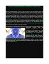 Meniere's disease treatment