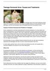 Teenage Hormonal Acne: Causes and Treatments