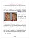 How Can You Benefit From Genioplasty? 