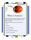 What is Cataract? 
