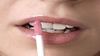 Tratamiento Herpes Labial