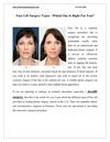 Face Lift Surgery Types - Which One Is Right For You?