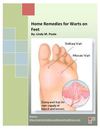 Home Remedies for Warts on Feet