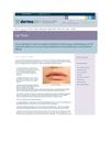 Manchester Botox Clinic Treatment